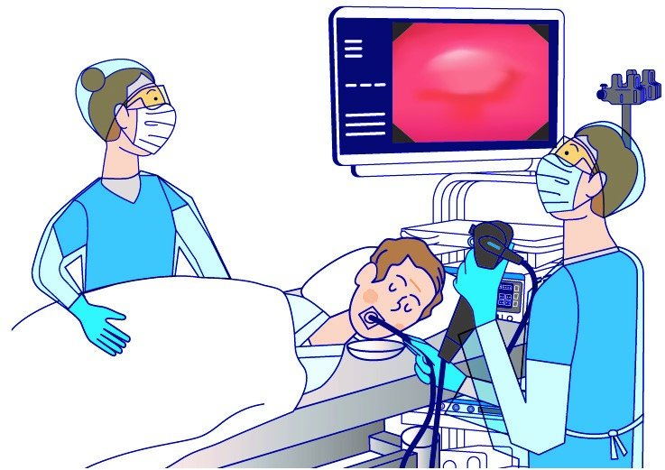 胃がん検診-8 胃がん検診-8